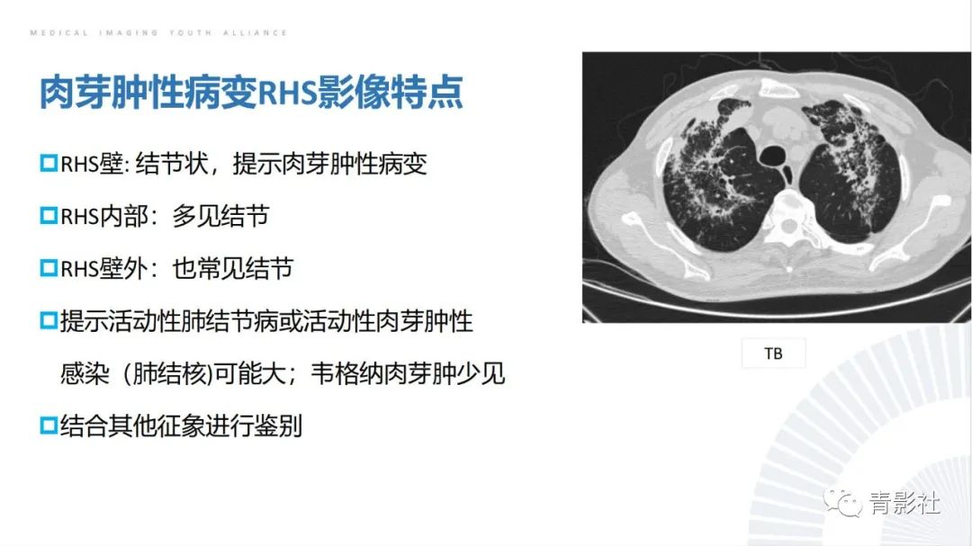 【PPT】肺部反晕征影像诊断思维-34