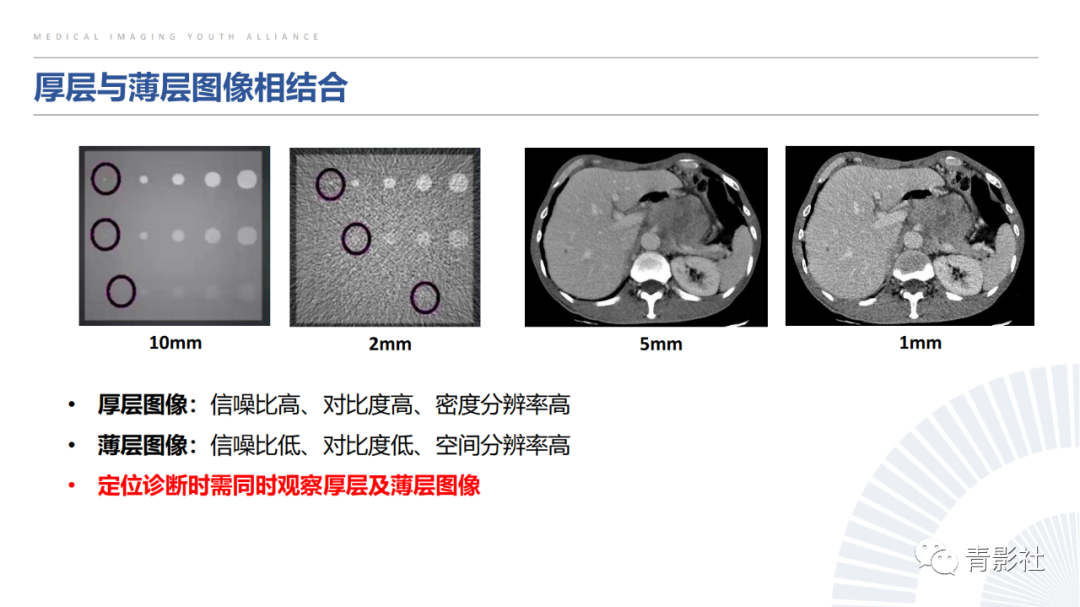 【PPT】左上腹肿块定位诊断思路-4