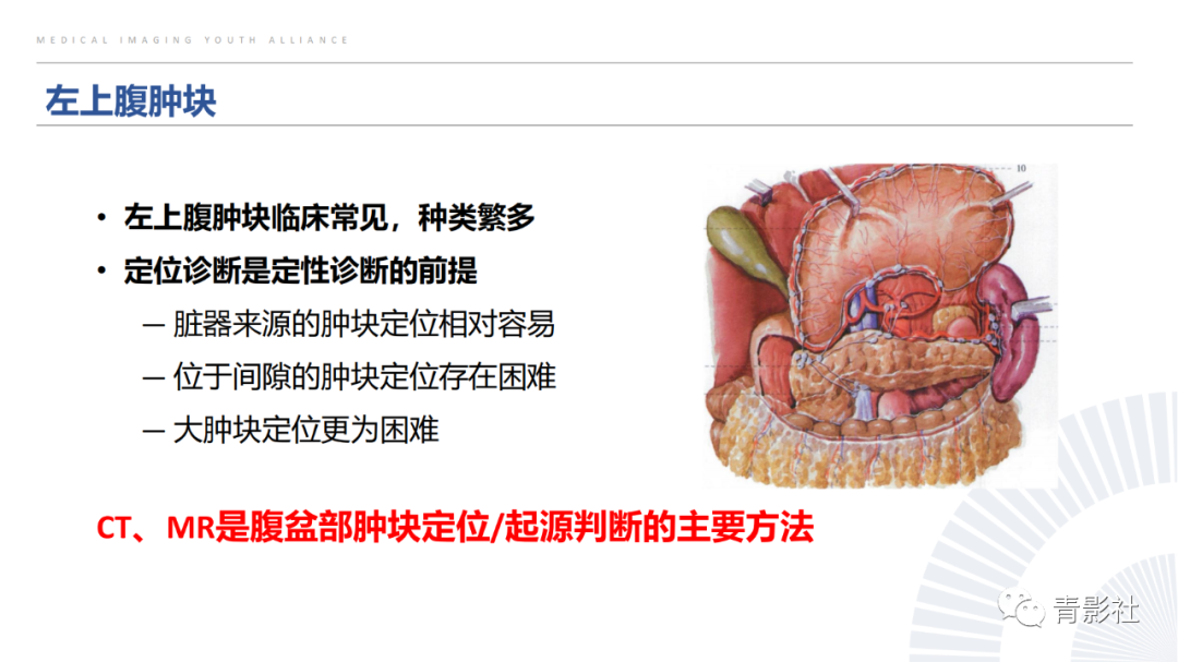 【PPT】左上腹肿块定位诊断思路-2