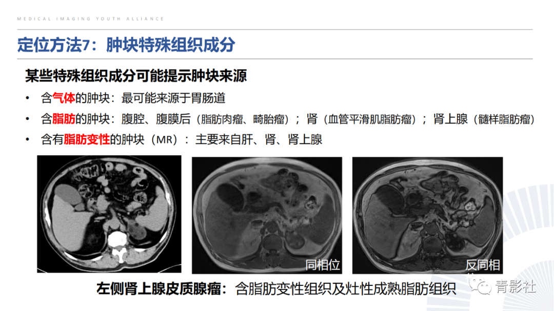 【PPT】左上腹肿块定位诊断思路-40