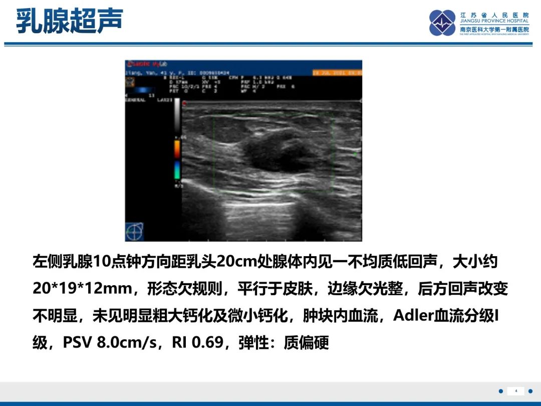 【PPT】三阴性乳腺癌-5