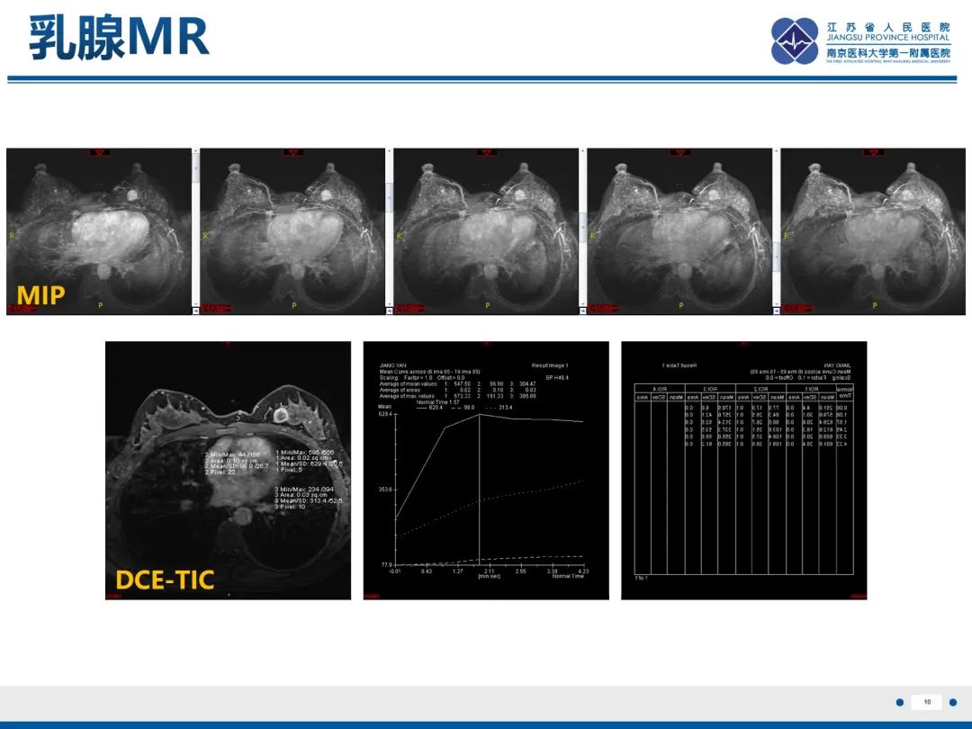 【PPT】三阴性乳腺癌-11