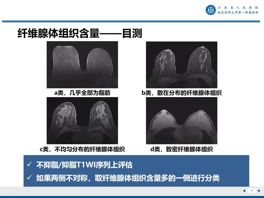 【PPT】三阴性乳腺癌-15