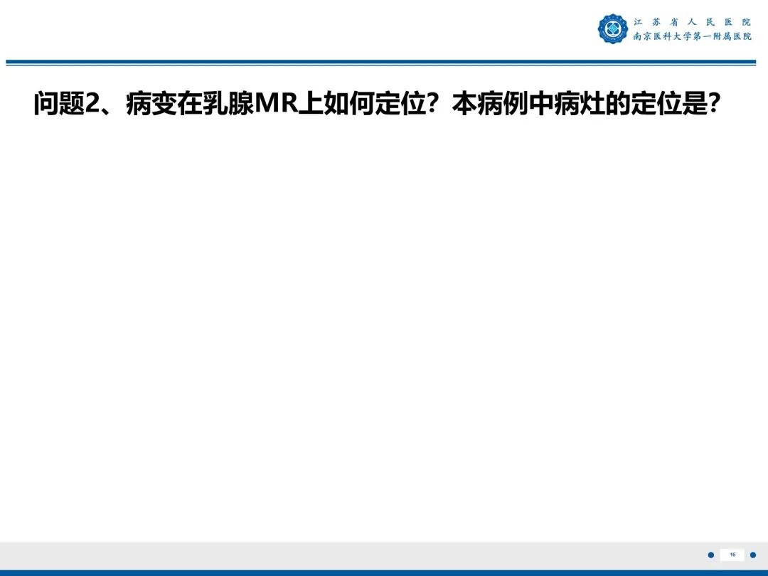 【PPT】三阴性乳腺癌-17