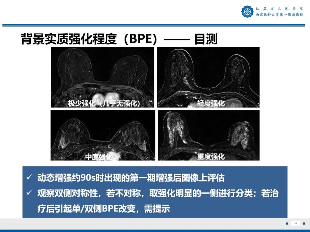 【PPT】三阴性乳腺癌-16