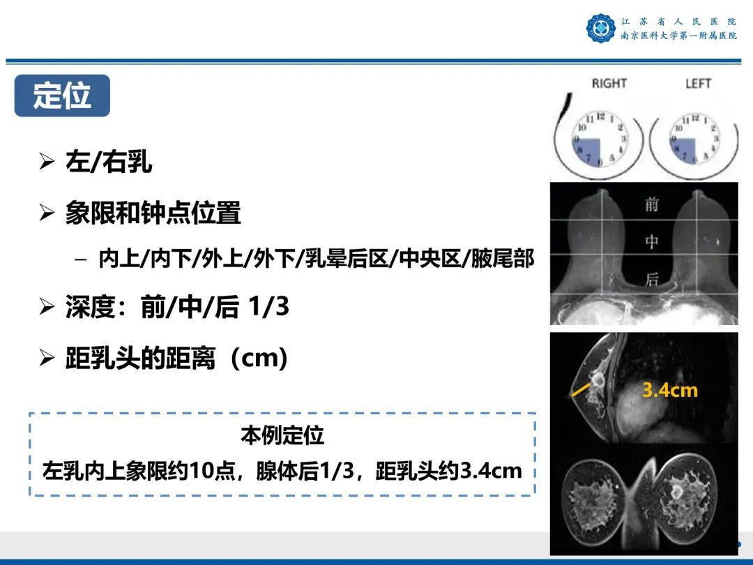 【PPT】三阴性乳腺癌-18