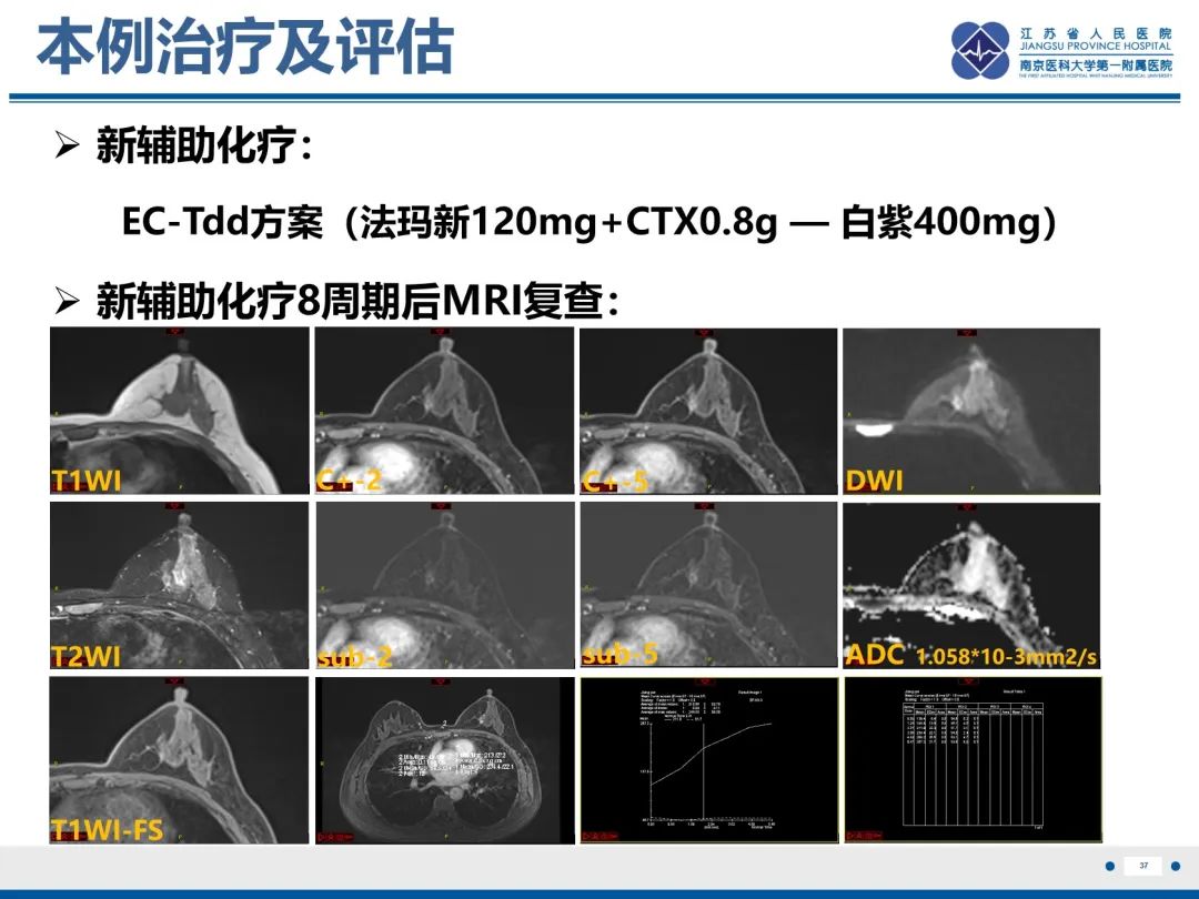 【PPT】三阴性乳腺癌-38
