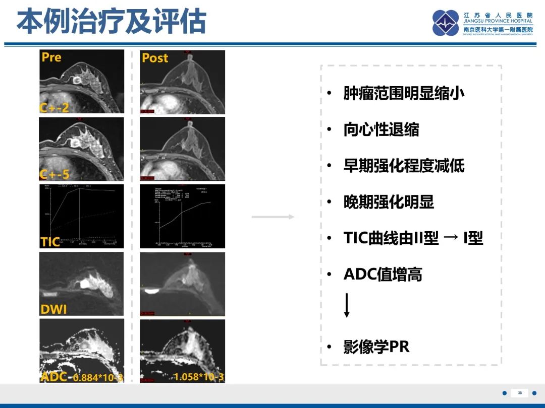 【PPT】三阴性乳腺癌-39