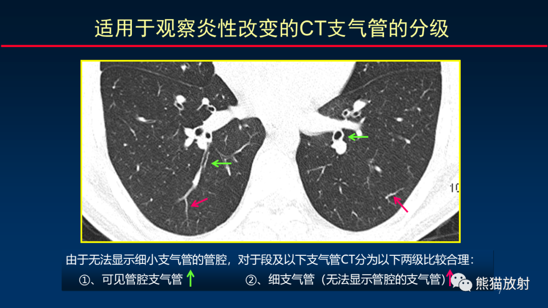 【PPT】HRCT对肺结核细节的观察进展-7