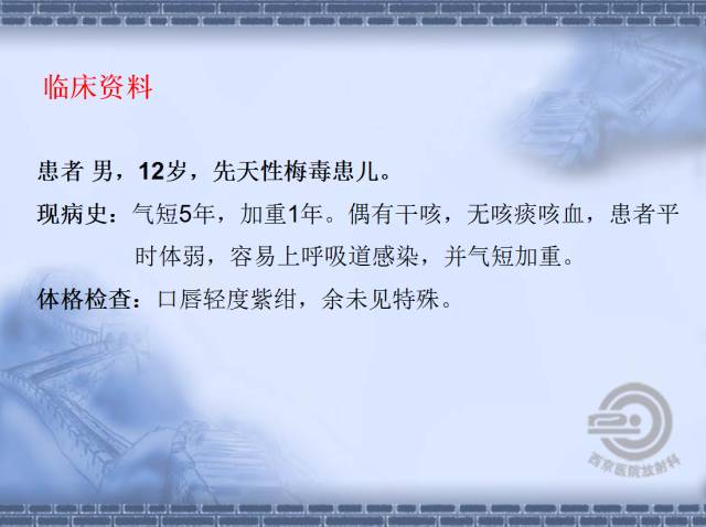 【病例】肺静脉闭塞性疾病1例CT影像表现