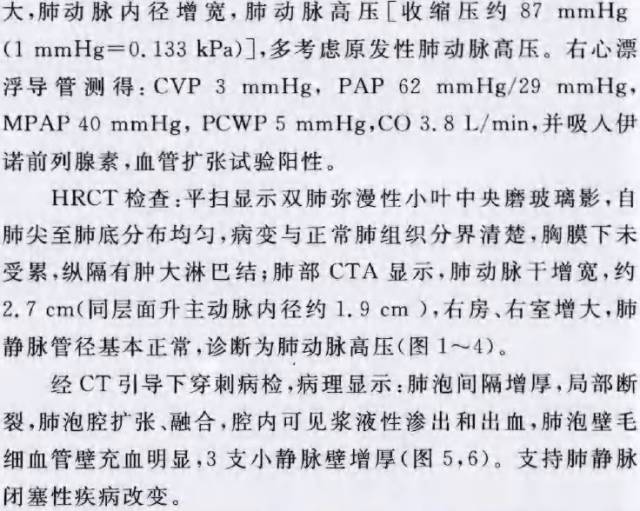 【病例】肺静脉闭塞性疾病1例CT影像表现