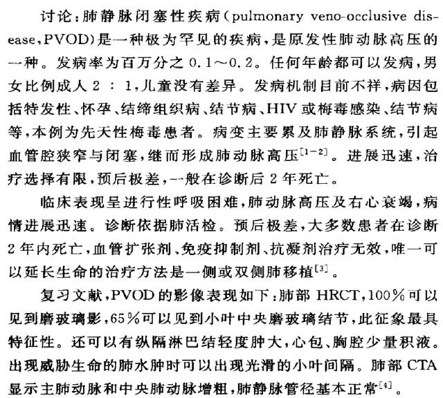 【病例】肺静脉闭塞性疾病1例CT影像表现