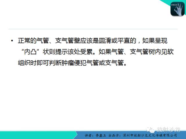 【原创】CT在食管癌诊疗中的应用