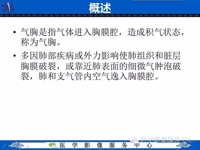 【影像征象】深沟征——气胸间接征象