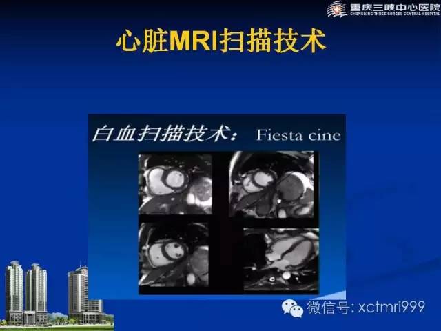 【PPT】心脏MRI简介及实例分析