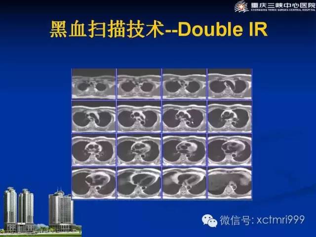 【PPT】心脏MRI简介及实例分析