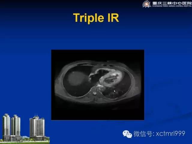 【PPT】心脏MRI简介及实例分析