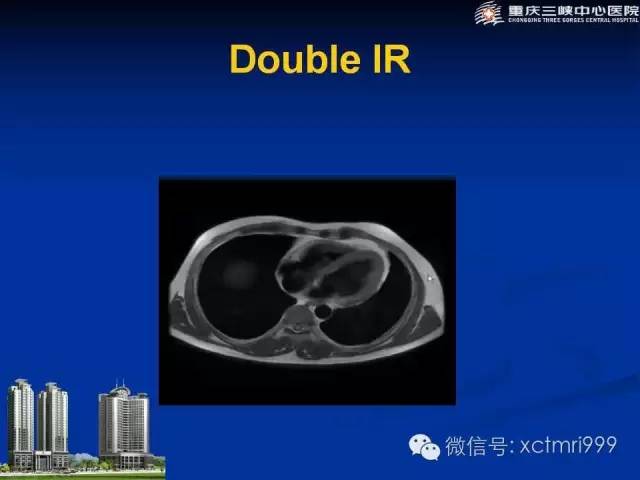 【PPT】心脏MRI简介及实例分析