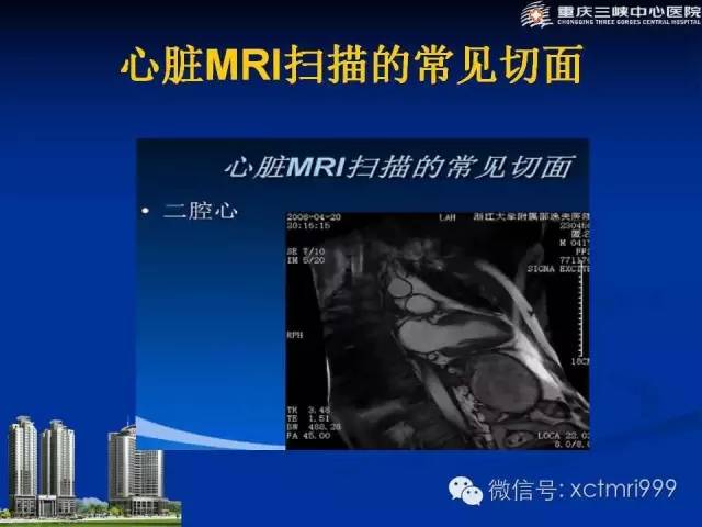 【PPT】心脏MRI简介及实例分析
