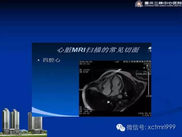 【PPT】心脏MRI简介及实例分析