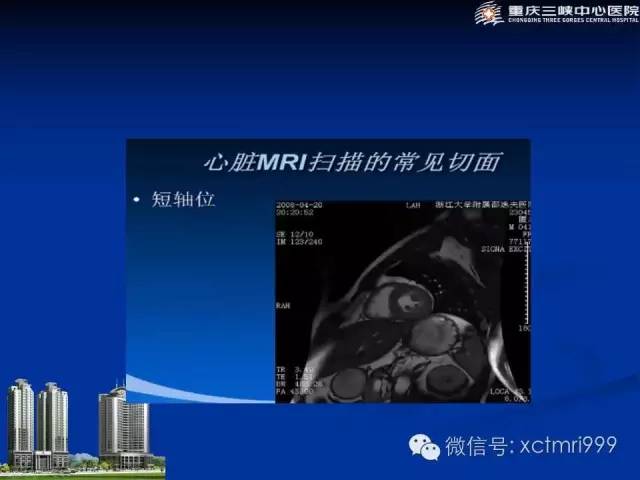 【PPT】心脏MRI简介及实例分析