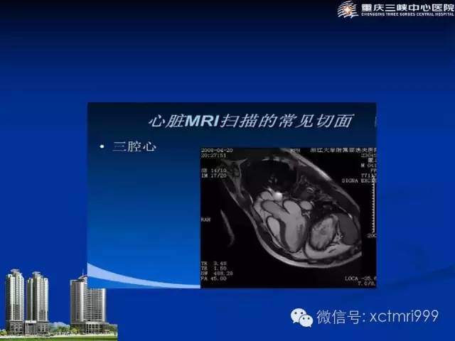 【PPT】心脏MRI简介及实例分析