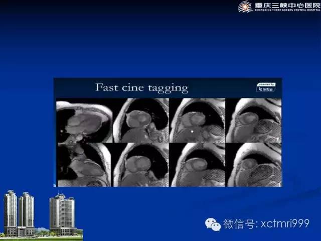 【PPT】心脏MRI简介及实例分析