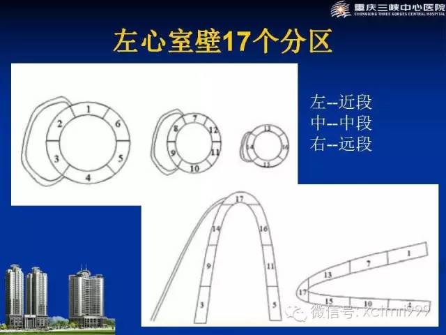 【PPT】心脏MRI简介及实例分析