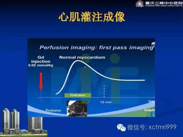 【PPT】心脏MRI简介及实例分析