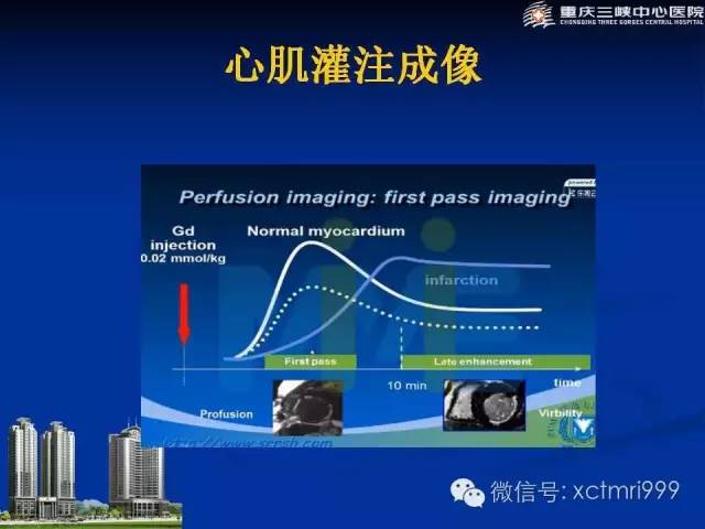 【PPT】心脏MRI简介及实例分析