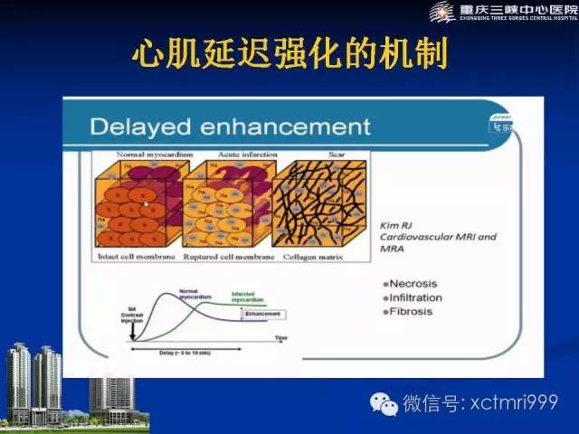 【PPT】心脏MRI简介及实例分析