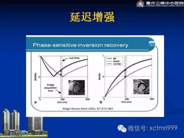 【PPT】心脏MRI简介及实例分析