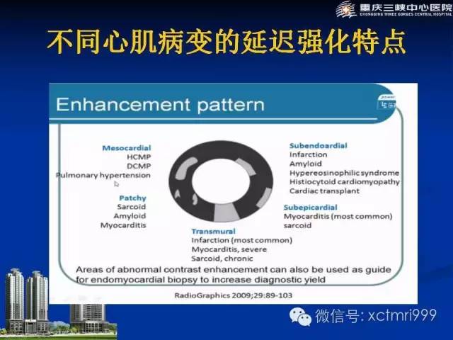 【PPT】心脏MRI简介及实例分析