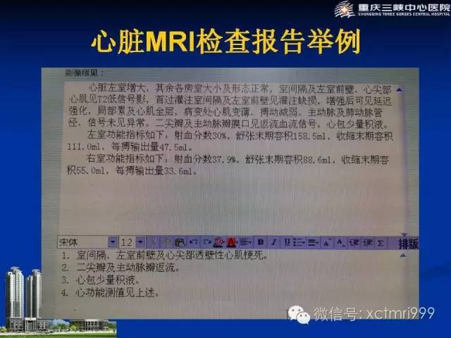 【PPT】心脏MRI简介及实例分析