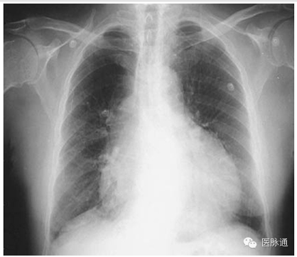 不容忽视的X线诊断要点
