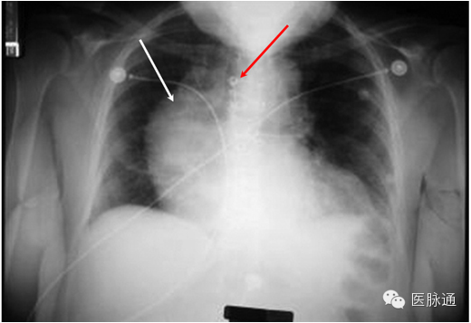 不容忽视的X线诊断要点