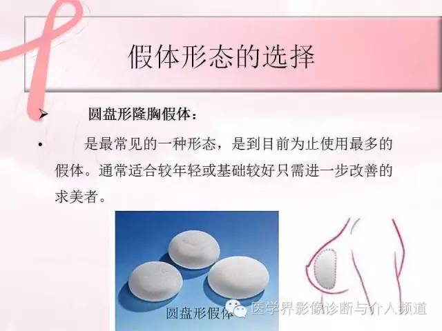【PPT】隆乳术及其MRI表现