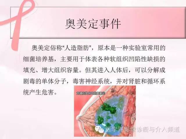 【PPT】隆乳术及其MRI表现