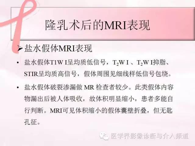 【PPT】隆乳术及其MRI表现