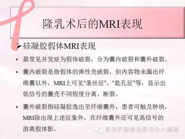 【PPT】隆乳术及其MRI表现