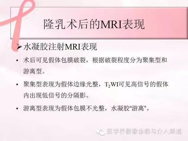 【PPT】隆乳术及其MRI表现