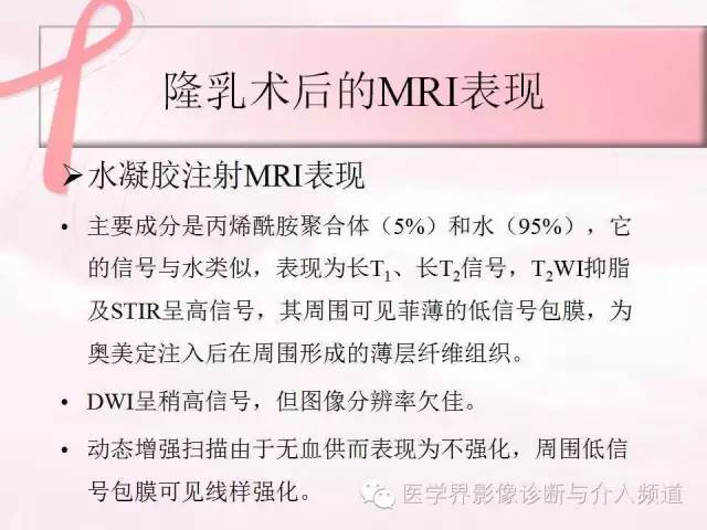 【PPT】隆乳术及其MRI表现
