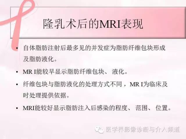 【PPT】隆乳术及其MRI表现