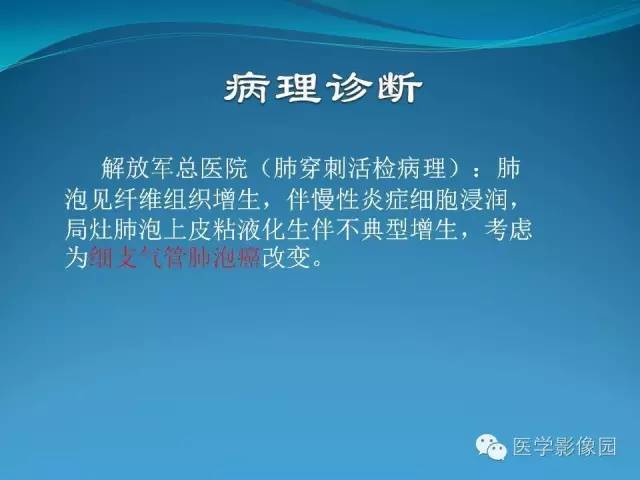 【病例】肺叶实变性支气管肺泡癌1例CT影像表现