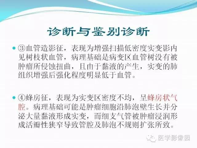 【病例】肺叶实变性支气管肺泡癌1例CT影像表现