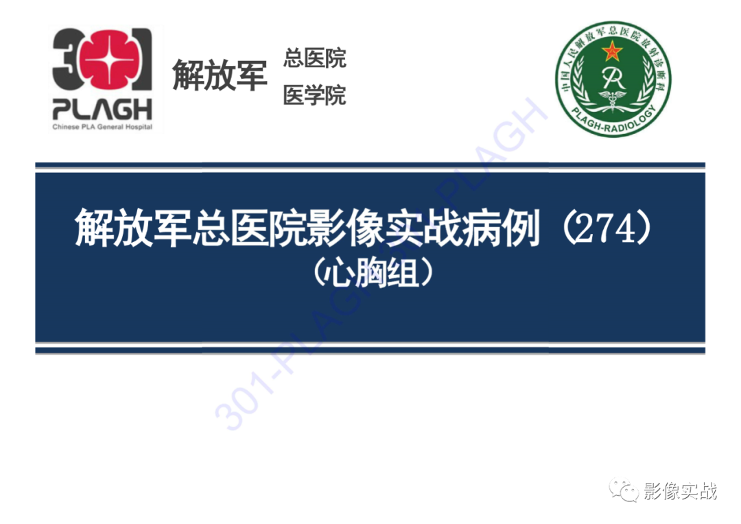 【病例】气管腺样囊性癌1例CT影像-1