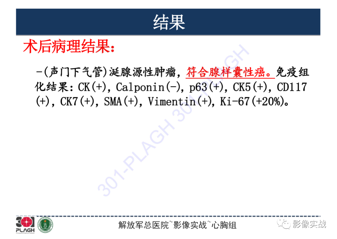 【病例】气管腺样囊性癌1例CT影像-11