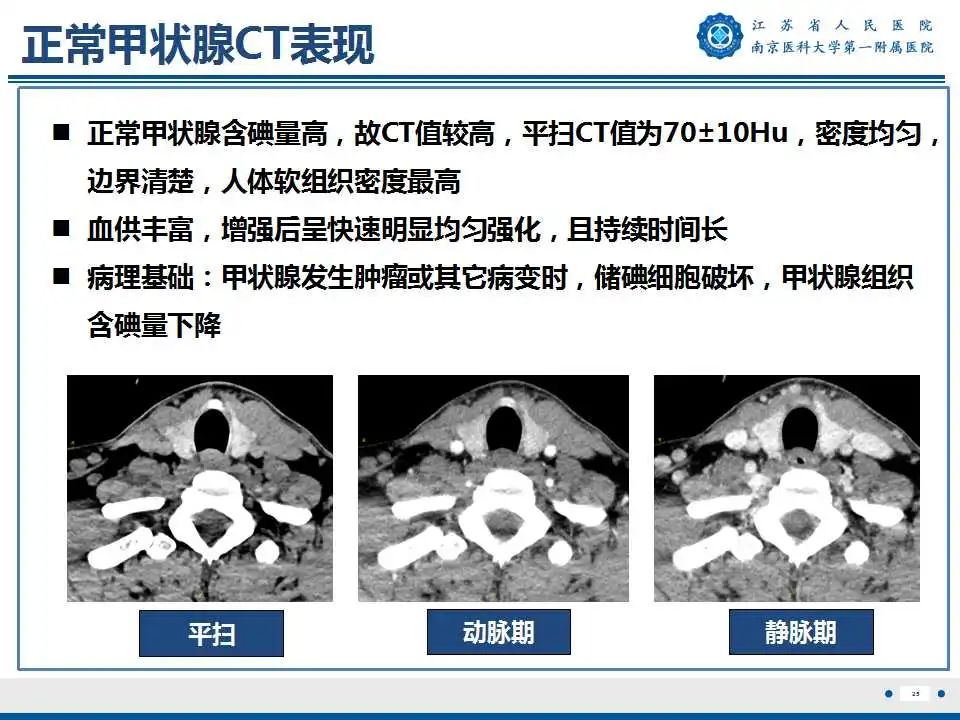 【PPT】甲状腺乳头状癌颈部淋巴结转移-26