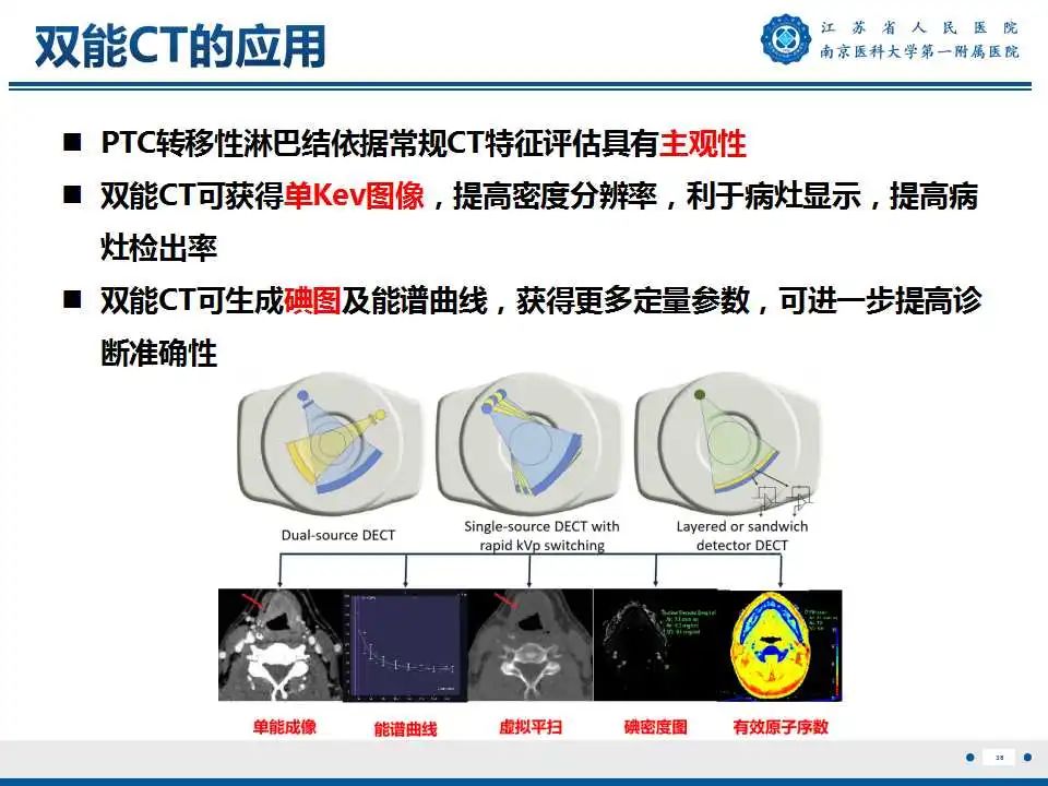 【PPT】甲状腺乳头状癌颈部淋巴结转移-39