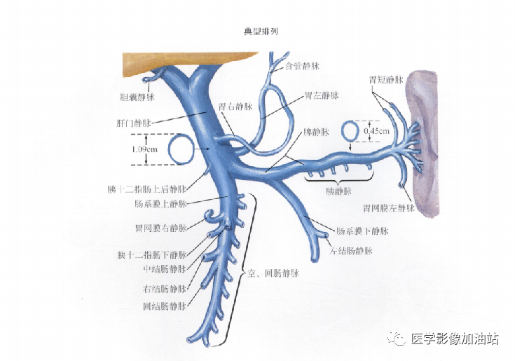肝门静脉系统解剖-8